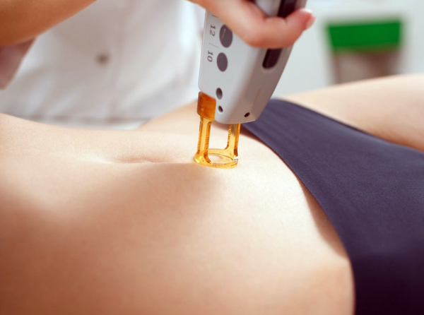 Belly Line Laser Hair Removal